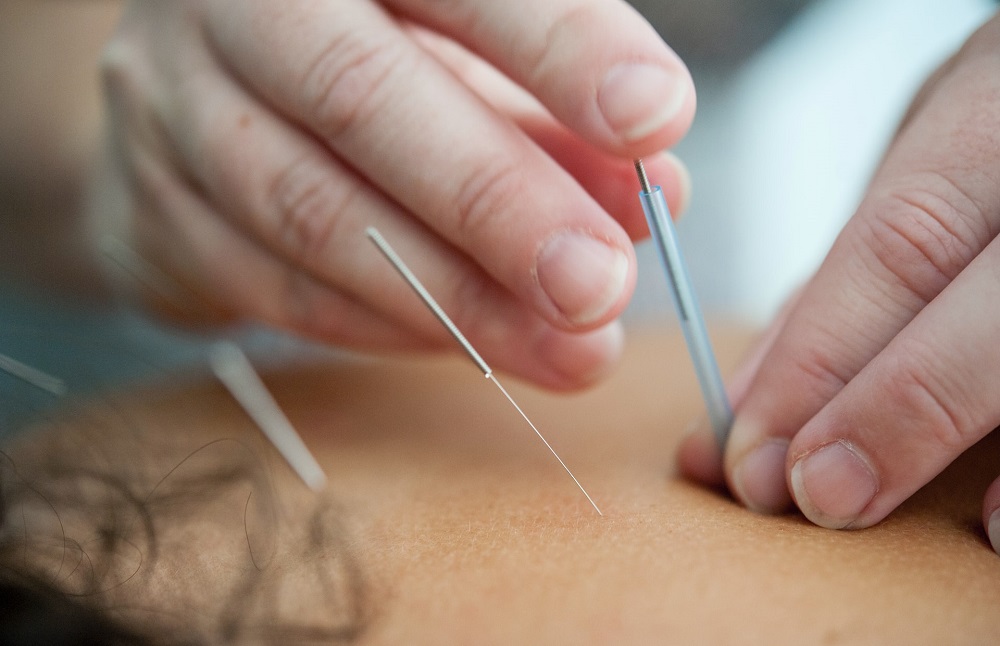 Dry Needling  Smithfield, NC 